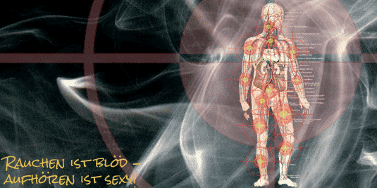 Arterienverkalkung Sliderbild: Arteriosklerose